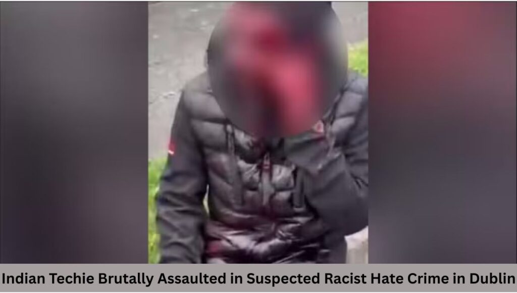 Indian Techie Brutally Assaulted in Suspected Racist Hate Crime in Dublin